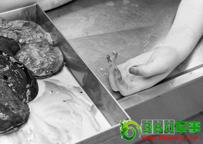 ʵ�ķ�ҽ����ʬ����ʵ����